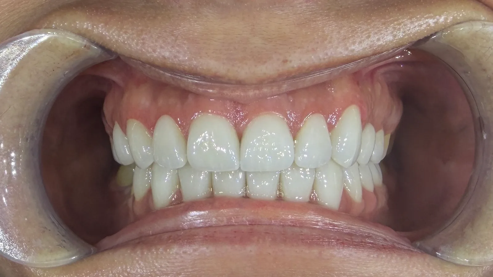 Denteca Smile Clinic Denteca Smile Clinic - stomatologie premium București