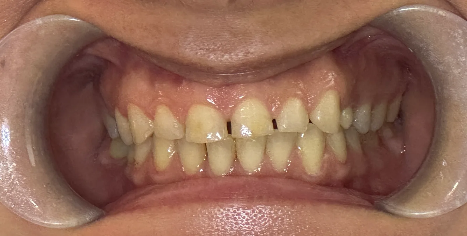 Denteca Smile Clinic Denteca Smile Clinic - stomatologie premium București