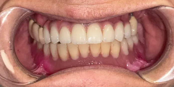 Denteca Smile Clinic Denteca Smile Clinic - stomatologie premium București