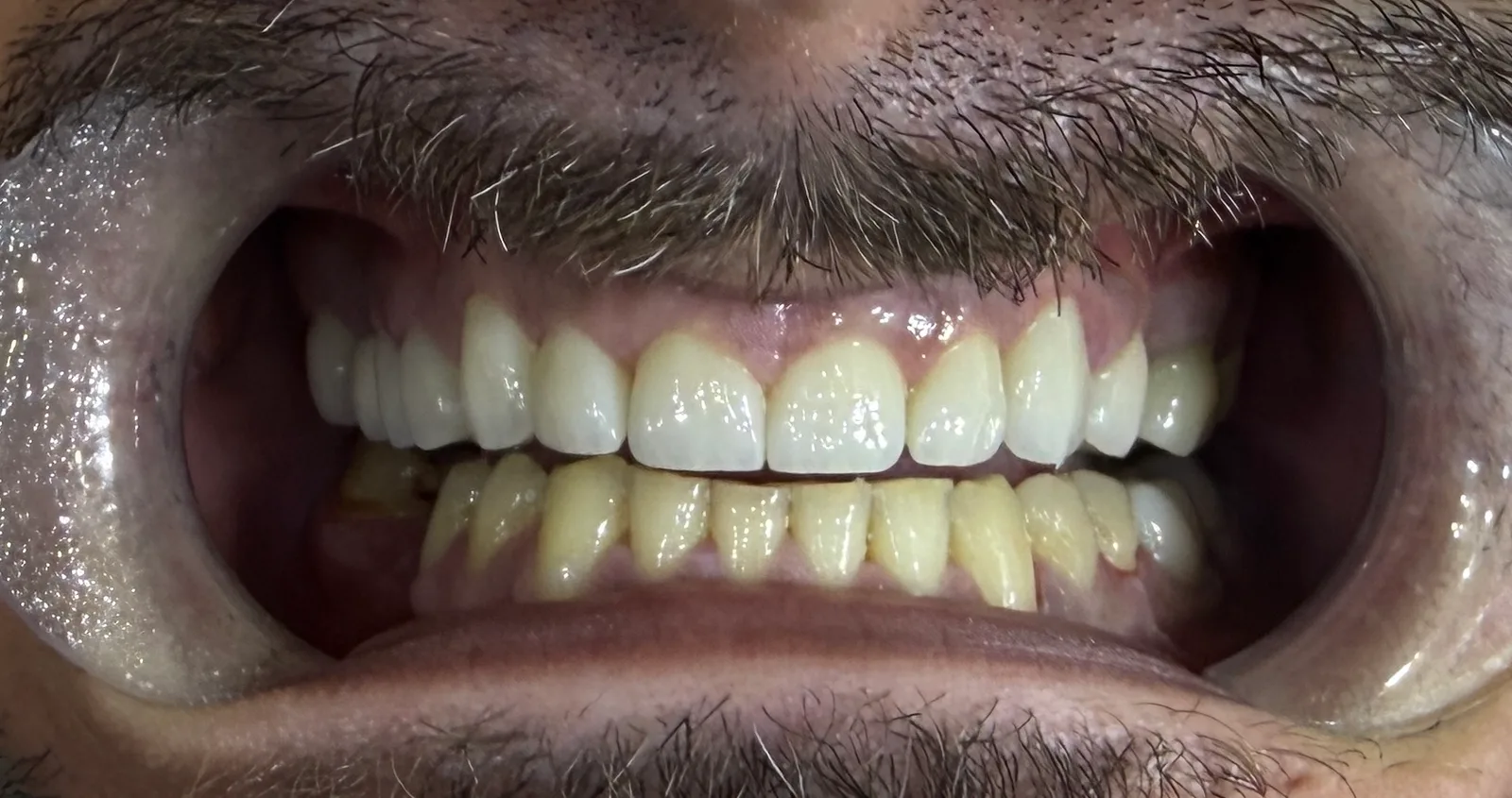 Denteca Smile Clinic Denteca Smile Clinic - stomatologie premium București