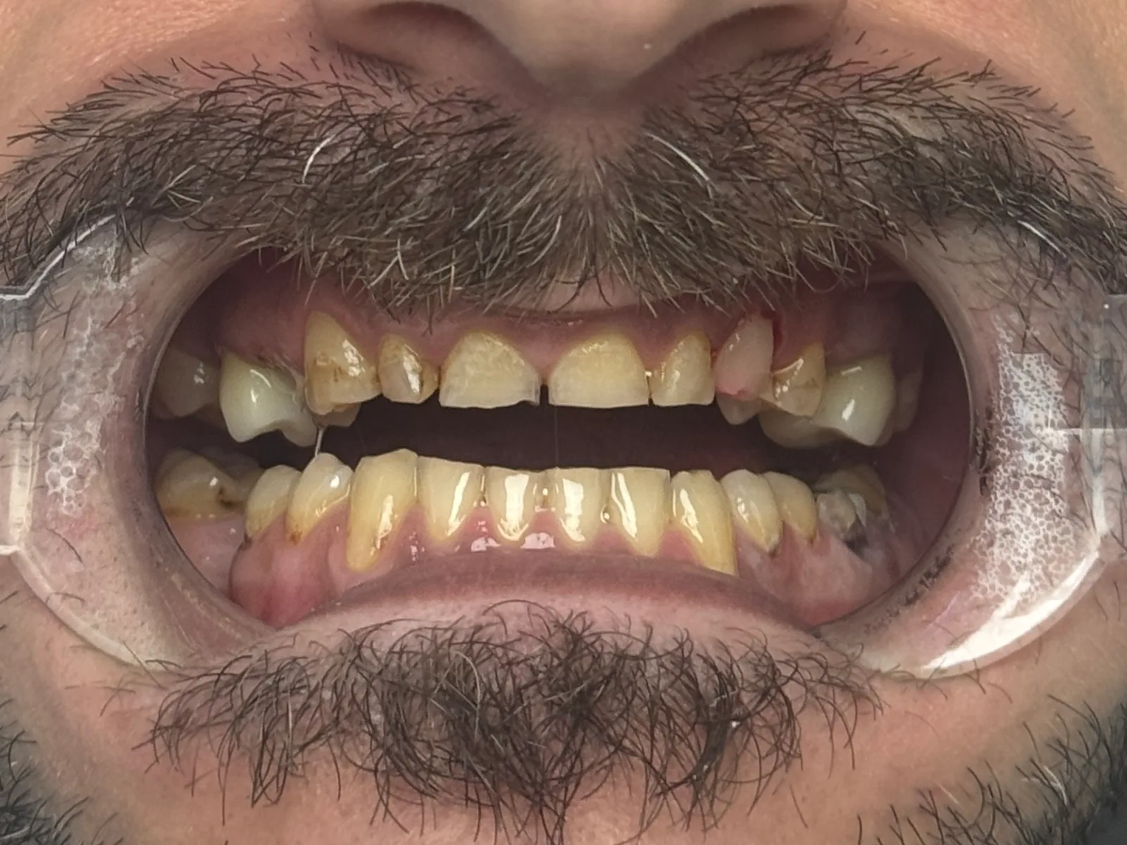 Denteca Smile Clinic Denteca Smile Clinic - stomatologie premium București