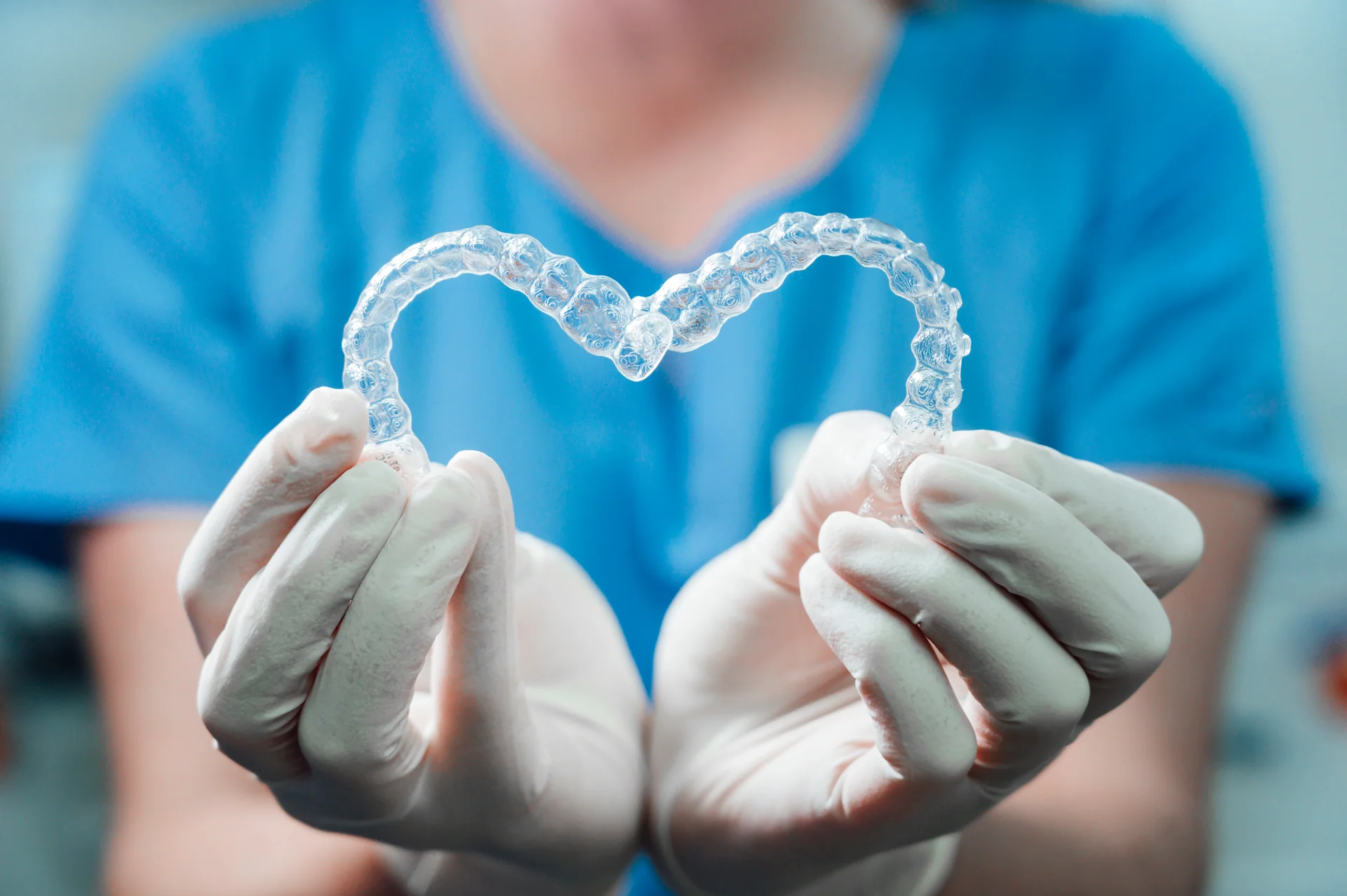 Spark aligners: o alternativă modernă la aparatele fixe
