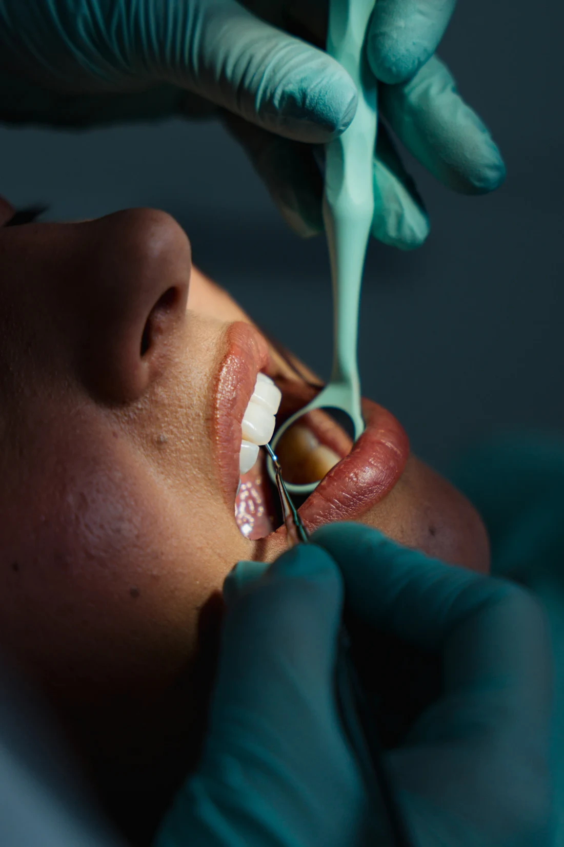 Denteca Smile Clinic - stomatologie premium București Consultație stomatologică Denteca Smile Clinic, expertiză și tehnologie de ultimă oră